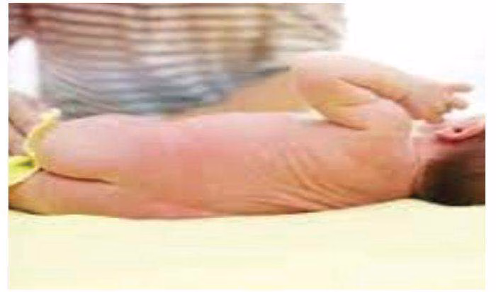 4063 babies stool may cause diarrhoea hepatitis paediatrician warns