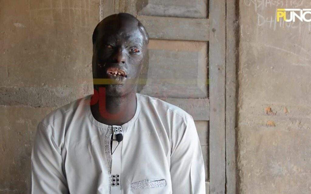 5987 how my cousin bathed fed me with acid as a baby