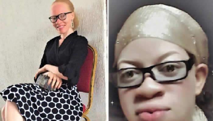 23296 ngo condemns skits stigmatising albinos
