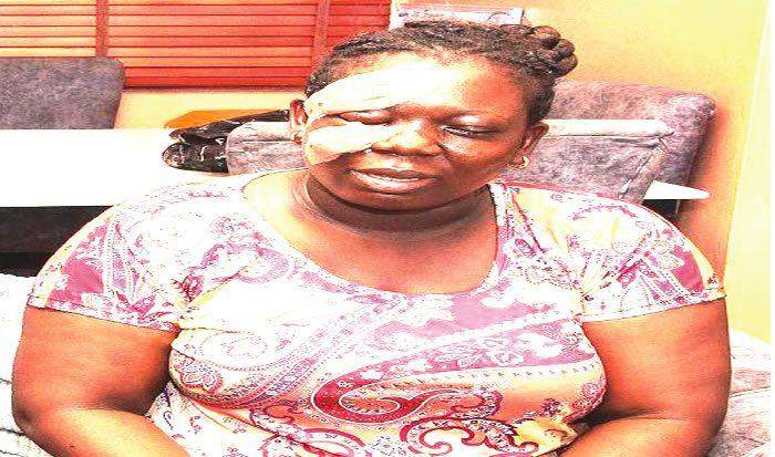 24734 i developed high blood pressure after polling booth attack lagos woman