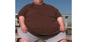 28488 nigeria ranks 180 out of 183 countries in obesity preparedness