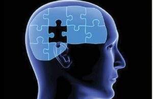 30531 footballers at higher risk of dementia study