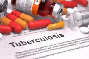 34270 nigerias tb case finding rises by 50 says who