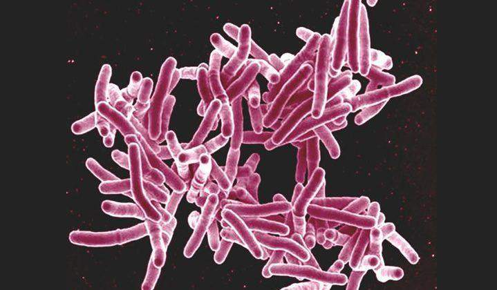 34325 experts differ on fgs commitment to ending tuberculosis