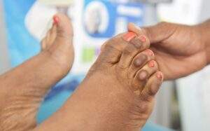 34560 nafdac seeks end to use of bleaching creams scaled