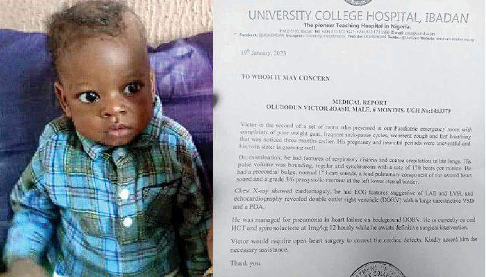 34644 nine month old needs n8m for heart surgery