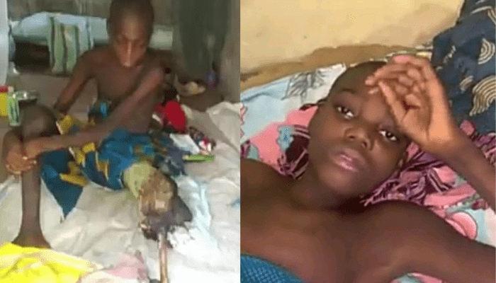 39227 17 year old to undergo leg amputation family seeks help