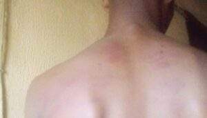 67914 mother takes action after lagos principal brutalizes 14 year old pupil