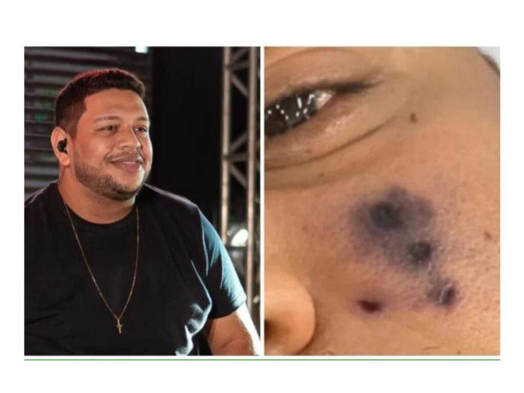 126852 popular brazilian singer darlyn morais succumbs to spider bite complications 126852 popular brazilian singer darlyn morais succumbs to spider bite complications