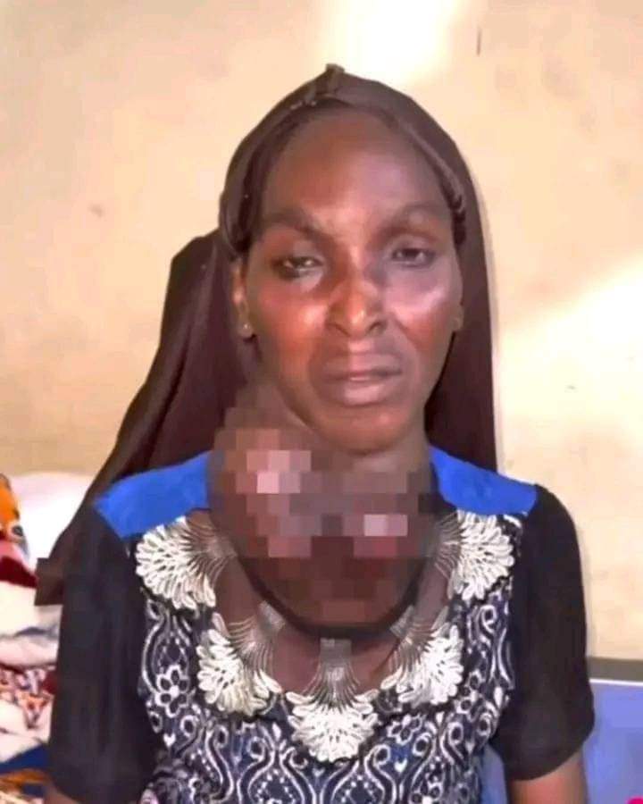 134280 osun state government extends support to goitre patient amid controversy
