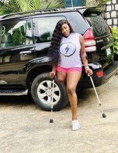 Men date me out of pity – Amputee actress Doris