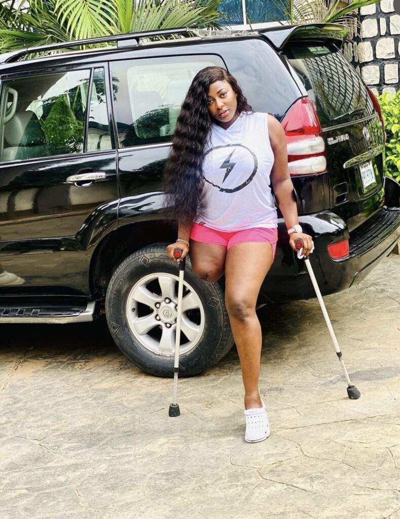 Men date me out of pity – Amputee actress Doris