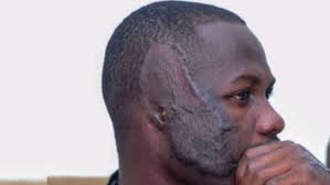 Man cuts off friends ear in Lagos — Daily Nigerian