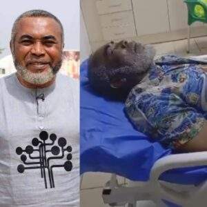 Zack Orji had brain surgery Minister of Arts solicits
