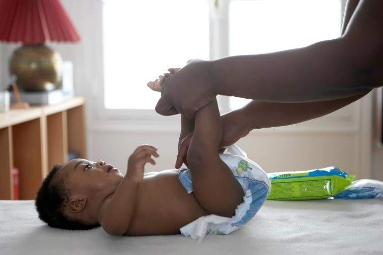 Delay in diaper change predisposes children to Urinary Tract Infection