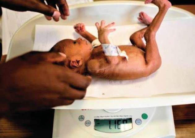 Stakeholders advocate rice fortification to combat anaemia