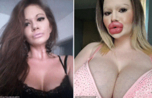 largest lip