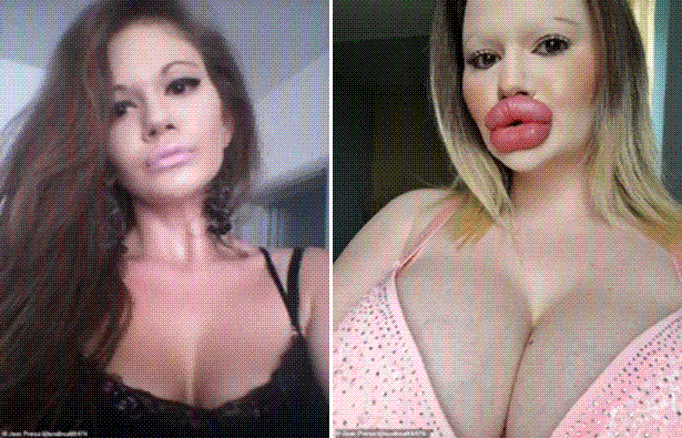 largest lip
