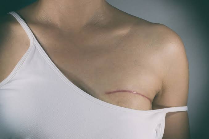 Distraught Father Pleads with Surgeon to Halt Transgender Surgery on