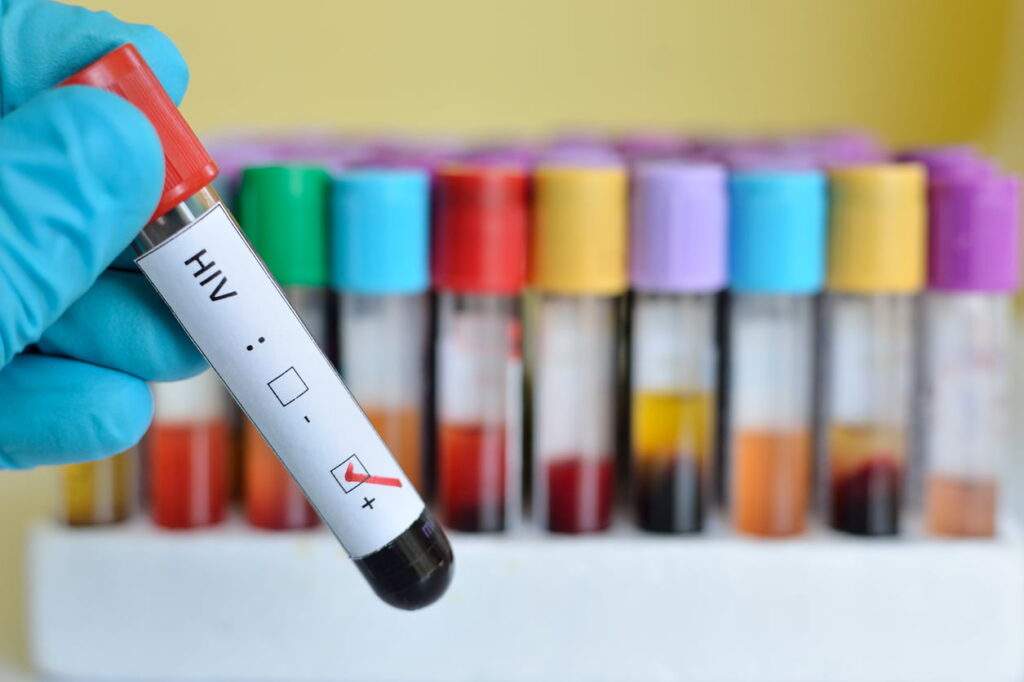 Kogi State: 50,000 Living with HIV/AIDS, 36,066 on Treatment, Stigma