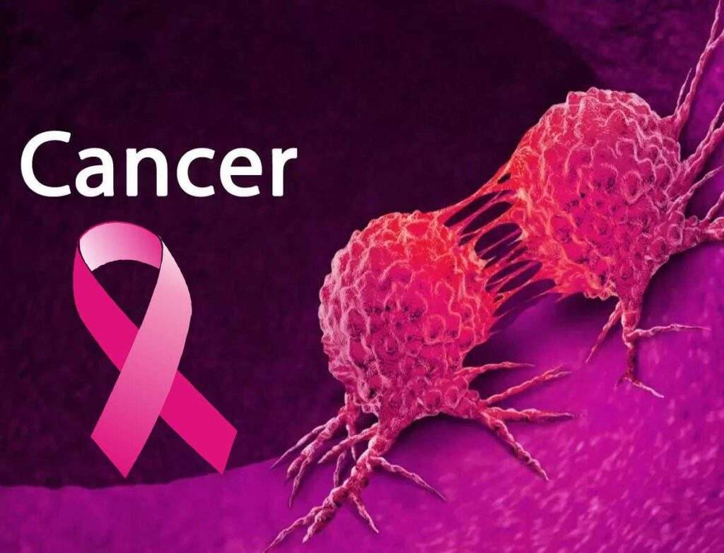Rotary Club of Abuja Supports Breast Cancer Patients in Neglected
