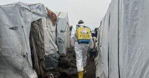 Democratic Republic Of Congo At The Epicenter Of Global Mpox 300x158