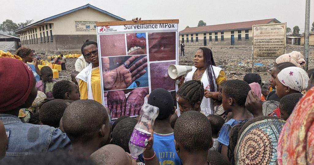 Monkeypox Outbreak Spreads in Congo with Rising Cases and Higher