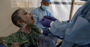 Mpox Outbreak Wreaks Havoc In DR Congo Patients Struggle With 300x158