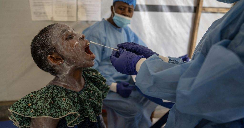 Mpox Outbreak Wreaks Havoc in DR Congo, Patients Struggle with
