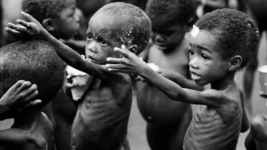 One in Four Nigerian Children Under Five Malnourished