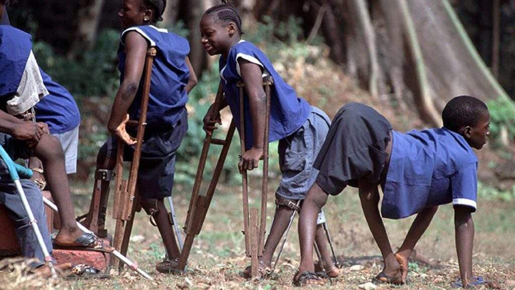 Polio Outbreak in Yobe 4 New Cases Confirmed