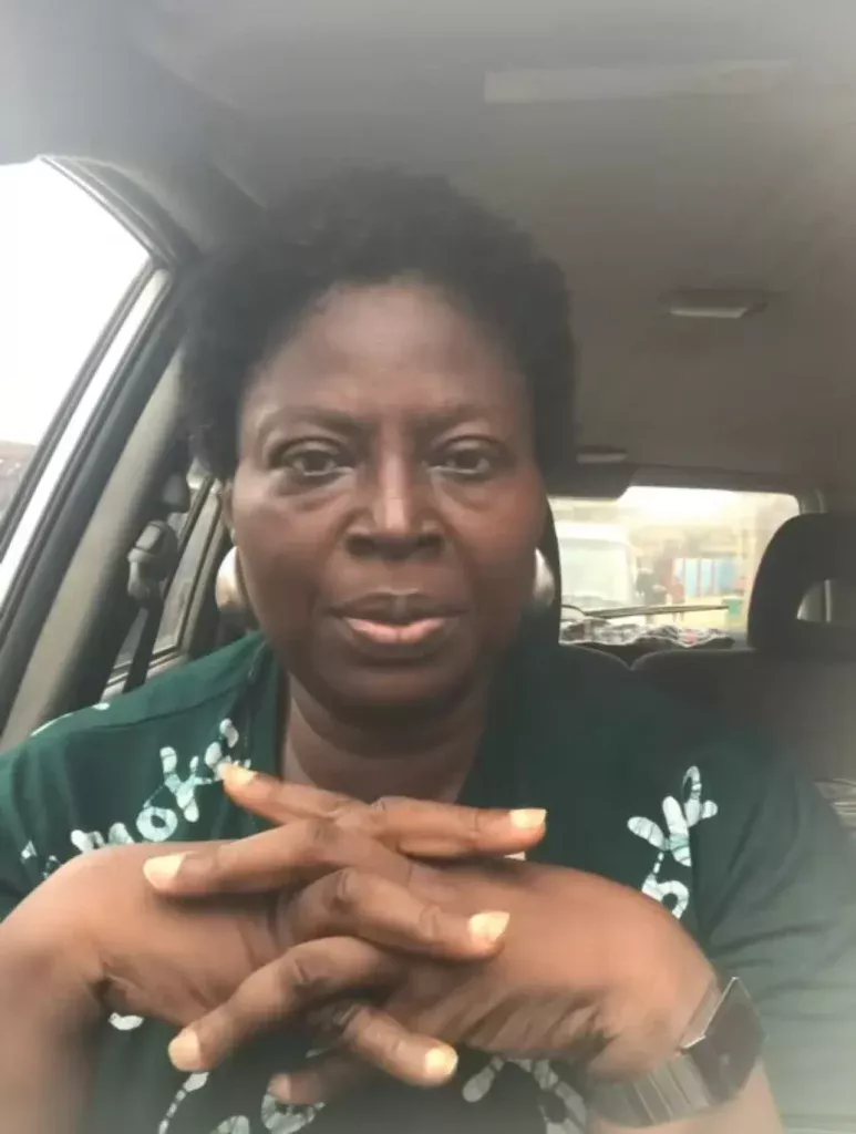 Nollywood Actress Warns Against Brazilian Butt Lift Surgery