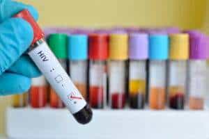 Girls' Rights Under Threat: 75% of HIV Infections in Adolescents