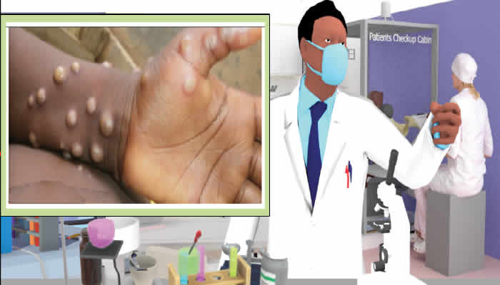 Mpox Spreads to 25 States in Nigeria