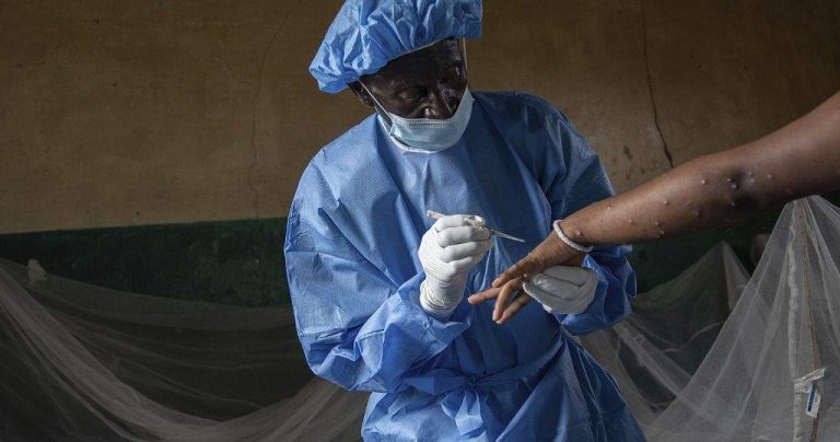Mpox Wreaks Havoc in Congos Sex Work Capital