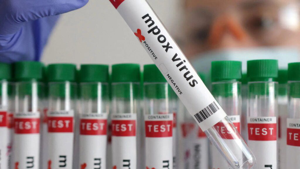 UK Detects First Case of mpox, Formerly Known as Monkeypox