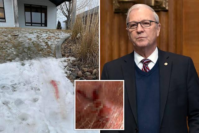 He went through a lot - Trump confirms Senator Kevin Cramer's head injury