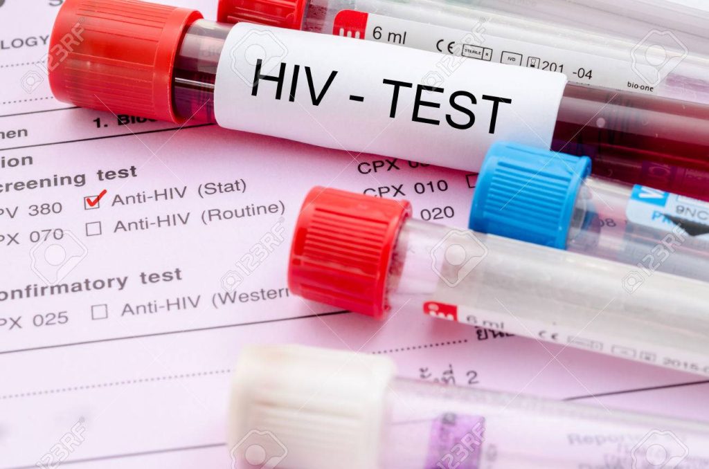 Experts welcome new HIV injection breakthrough, decry high cost — Daily Nigerian