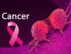 Sugary drinks, refined carbohydrates, processed meats, major causes of cancer - Varsity Don