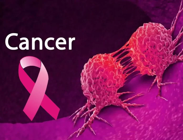Sugary drinks, refined carbohydrates, processed meats, major causes of cancer - Varsity Don