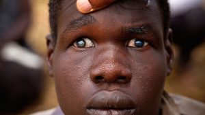 23 million Nigerians suffer from eye problems - Expert
