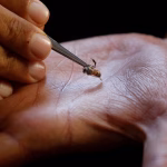 In Kenya, bee stings are being used to treat illnesses