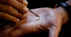 Bee Venom Therapy Treats Chronic Conditions Naturally 300x158