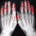 Radiography expert warns of manpower crisis as demand surges