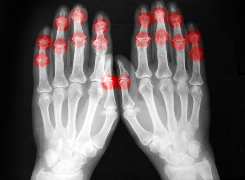 Radiography expert warns of manpower crisis as demand surges