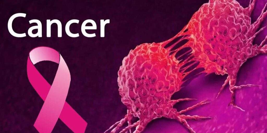 107123 middle aged women at higher risk of cancer expert 107123 middle aged women at higher risk of cancer expert
