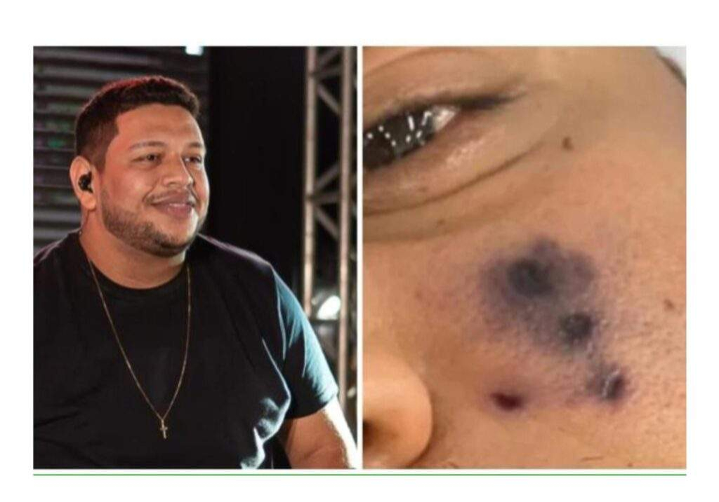 126852 popular brazilian singer darlyn morais succumbs to spider bite complications