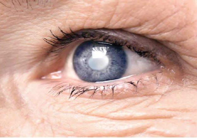 19008 no glaucoma 19008 no glaucoma