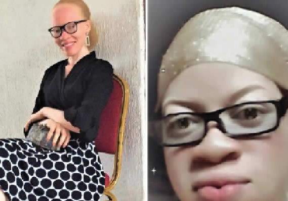 23296 ngo condemns skits stigmatising albinos