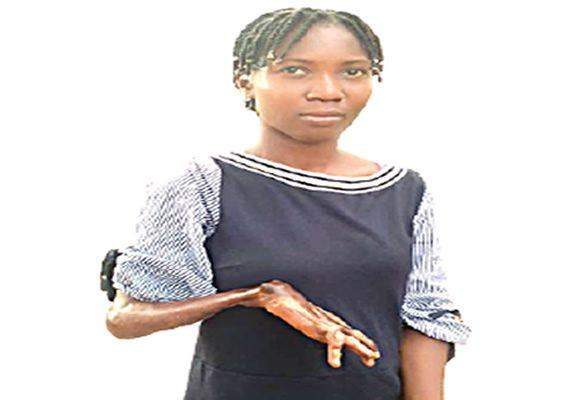 24326 how my disability denied me utme registration admission seeker